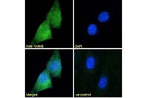 ABIN184679 Immunofluorescence analysis of paraformaldehyde fixed NIH3T3 cells, permeabilized with 0. (NUMB anticorps  (C-Term))