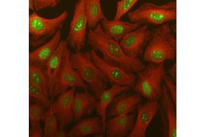 IF analysis of TDG using anti-TDG antibody (ABIN7600107) and anti-Tubulin Alpha antibody (ABIN7600339).