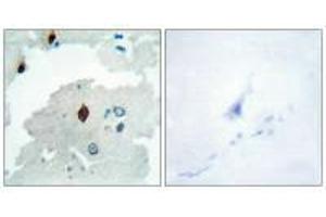 Immunohistochemistry analysis of paraffin-embedded human brain tissue using PTTG antibody. (PTTG1IP anticorps  (C-Term))