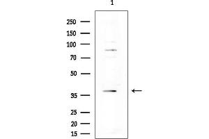 anti-Islet Amyloid Polypeptide (IAPP) (Internal Region) antibody
