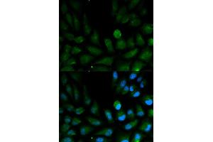 Immunofluorescence analysis of HepG2 cell using CAPZA2 antibody. (CAPZA2 anticorps)