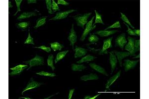 Immunofluorescence of purified MaxPab antibody to GRIPAP1 on HeLa cell. (GRIPAP1 anticorps  (AA 1-841))