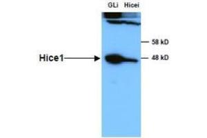 Anti-HICE1 in Western Blot using  Immunochemicals' Anti-HICE1 Antibody shows detection of a 45 kDa band corresponding to endogenous HICE1 in lysates of S phase HeLa cells silenced for either control Luciferase or HICE1. (NYS48/HAUS8 anticorps)
