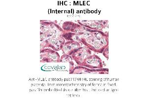 Image no. 1 for anti-Malectin (MLEC) (Internal Region) antibody (ABIN1736973) (Malectin anticorps  (Internal Region))