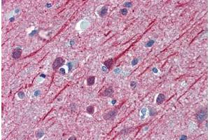 Human Brain, Cortex: Formalin-Fixed, Paraffin-Embedded (FFPE) (TUBB2A anticorps  (AA 1-446))