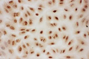 Anti-PIAS1 antibody, ICC ICC: A549 Cell