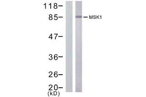 Western blot analysis of extract from HuVec cells treated or untreated with PMA (200nM, 30min), using MSK1 (Ab-376) antibody (E021198). (MSK1 anticorps)