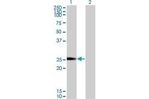 Western Blot analysis of NXNL1 expression in transfected 293T cell line by TXNL6 monoclonal antibody (M01), clone 7H3. (NXNL1 anticorps  (AA 81-190))