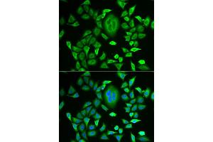 Immunofluorescence analysis of MCF-7 cells using RBP3 antibody. (RBP3 anticorps)