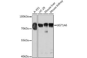 Western blot analysis of extracts of various cell lines, using UGT1 Rabbit pAb (ABIN7271193) at 1:1000 dilution.