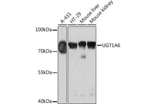 UGT1A6 anticorps  (AA 65-270)