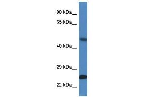 Western Blot showing Snx10 antibody used at a concentration of 1. (SNX10 anticorps  (Middle Region))