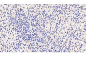 Detection of EMR1 in Human Spleen Tissue using Polyclonal Antibody to EGF Like Module Containing Mucin Like Hormone Receptor 1 (EMR1)
