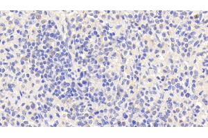 Detection of EMR1 in Human Spleen Tissue using Polyclonal Antibody to EGF Like Module Containing Mucin Like Hormone Receptor 1 (EMR1) (F4/80 anticorps  (AA 1-201))