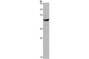 Western Blotting (WB) image for anti-Acid Phosphatase 6, Lysophosphatidic (ACP6) antibody (ABIN2430391) (ACP6 anticorps)