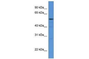 Western Blot showing HARS antibody used at a concentration of 1 ug/ml against 293T Cell Lysate (HARS1/Jo-1 anticorps  (N-Term))