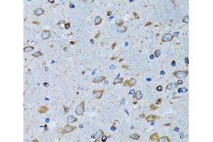 Immunohistochemistry of paraffin-embedded Mouse brain using RARS Polyclonal Antibody at dilution of 1:100 (40x lens). (RARS anticorps)