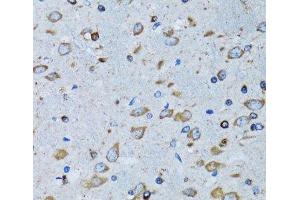 Immunohistochemistry of paraffin-embedded Mouse brain using RARS Polyclonal Antibody at dilution of 1:100 (40x lens).