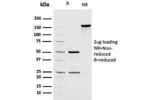SDS-PAGE Analysis of Purified MSH2 Mouse Monoclonal Antibody (MSH2/2622).