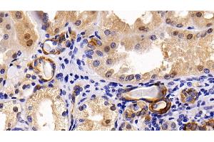 Detection of CK17 in Human Kidney Tissue using Polyclonal Antibody to Cytokeratin 17 (CK17)