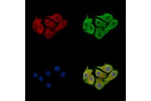 ABIN7097098 and ABIN7101165 staining Hela cells by IF/ICC.