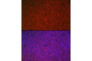 Immunofluorescence analysis of rat spleen cells using ETS1 Rabbit pAb (ABIN7271258) at dilution of 1:100 (40x lens).