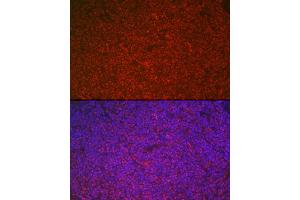 Immunofluorescence analysis of rat spleen cells using ETS1 Rabbit pAb (ABIN7271258) at dilution of 1:100 (40x lens).