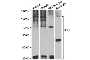 Western blot analysis of extracts of various cell lines, using UBC antibody. (UBC anticorps  (AA 1-100))