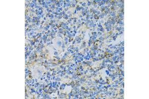 Immunohistochemistry of paraffin-embedded rat spleen using RPL13 antibody (ABIN1682571, ABIN5664631, ABIN5664633 and ABIN6220492) at dilution of 1:100 (40x lens). (RPL13 anticorps  (AA 1-211))