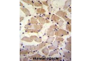 SUSD5 Antibody (C-term) immunohistochemistry analysis in formalin fixed and paraffin embedded human skeletal muscle followed by peroxidase conjugation of the secondary antibody and DAB staining. (SUSD5 anticorps  (C-Term))