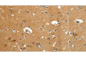 Immunohistochemistry of paraffin-embedded Human brain tissue using AMD1 Polyclonal Antibody at dilution 1:40