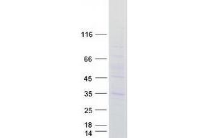 Validation with Western Blot