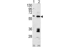 Western blot analysis of anti-MDM2 antibody and 293 cell lysate (2 ug/lane) either nontransfected (Lane 1) or transiently transfected with the MDM2 gene (2).