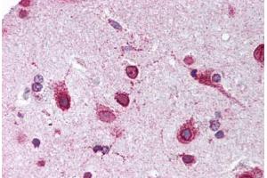 Human Brain, Cortex (formalin-fixed, paraffin-embedded) stained with PHB2 antibody ABIN239837 at 1:50 followed by biotinylated goat anti-rabbit IgG secondary antibody ABIN481713, alkaline phosphatase-streptavidin and chromogen. (Prohibitin 2 anticorps  (C-Term))