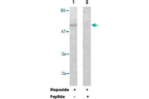 Western blot analysis of extracts from HeLa cells, treated with Etoposide (25 uM, 24 hours), using AKT1 polyclonal antibody . (AKT1 anticorps)