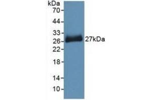 Detection of Recombinant PNOC, Mouse using Polyclonal Antibody to Pronociceptin (PNOC)