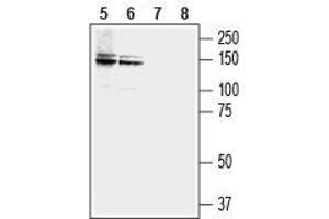 Western blot analysis of human LNCaP  prostate carcinoma (lanes 5 and 7) and MCF-7 breast adenocarcinoma (lanes 6 and 8) cell lysates: - 5,6. (NCAM2 anticorps  (Extracellular, N-Term))