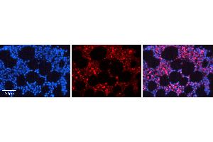 Rabbit Anti-NFKB1 Antibody   Formalin Fixed Paraffin Embedded Tissue: Human Bone Marrow Tissue Observed Staining: Nucleus, Cytoplasm Primary Antibody Concentration: 1:600 Other Working Concentrations: N/A Secondary Antibody: Donkey anti-Rabbit-Cy3 Secondary Antibody Concentration: 1:200 Magnification: 20X Exposure Time: 0.
