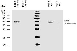 Western blotting analysis of human acidic cytokeratins using mouse monoclonal antibody AE1 on lysates of MCF-7 cell line and Molt-4 cell line (cytokeratin non-expressing cell line, negative control) under non-reducing and reducing conditions. (Keratin Acidic (AE1) anticorps)
