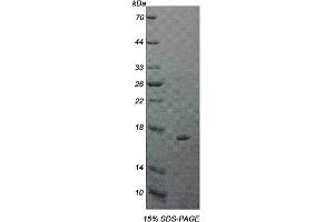 15% SDS-PAGE analysis of recombinant IL5Ra Protein. (IL5RA Protéine)