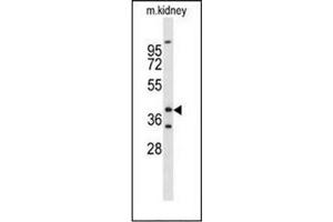 Western blot analysis ofFOXL1 / FKHL11 Antibody (Center) in mouse kidney tissue lysates (35ug/lane).