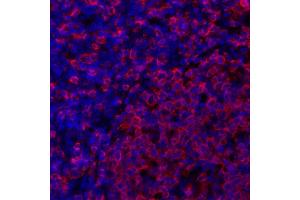 Immunofluorescence (IF) image for anti-HLA-DR (HLA-DR) antibody (ABIN7449537) (HLA-DR anticorps)