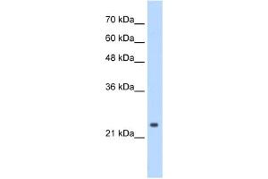 WB Suggested Anti-CPSF4 Antibody Titration:  0.