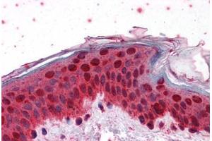 Human Skin: Formalin-Fixed, Paraffin-Embedded (FFPE)