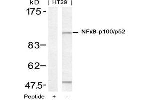 Image no. 3 for anti-Nuclear Factor of kappa Light Polypeptide Gene Enhancer in B-Cells 2 (NFKB2) (Ser871) antibody (ABIN197572) (NFKB2 anticorps  (Ser871))