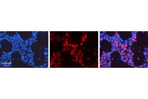 Rabbit Anti-TUBB2A Antibody Catalog Number: ARP40177_P050 Formalin Fixed Paraffin Embedded Tissue: Human Bone Marrow Tissue Observed Staining: Cytoplasm Primary Antibody Concentration: 1:100 Other Working Concentrations: 1:600 Secondary Antibody: Donkey anti-Rabbit-Cy3 Secondary Antibody Concentration: 1:200 Magnification: 20X Exposure Time: 0.