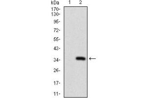 Western Blotting (WB) image for anti-ATP-Binding Cassette, Sub-Family C (CFTR/MRP), Member 4 (ABCC4) (AA 631-692) antibody (ABIN1845662)