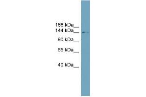 WB Suggested Anti-SLC4A2 Antibody Titration: 0. (SLC4A2 anticorps  (N-Term))
