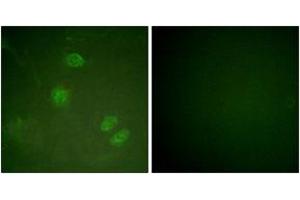 Immunofluorescence analysis of HeLa cells, using Elk3 (Ab-357) Antibody. (ELK3 anticorps  (AA 323-372))