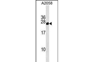 CYorf15B Antibody (Center) (ABIN1538521 and ABIN2849472) western blot analysis in  cell line lysates (35 μg/lane).